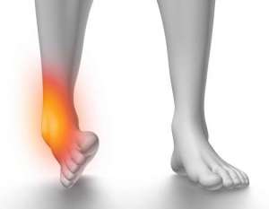 Ankle Sprain Physiotherapy in Jaipur